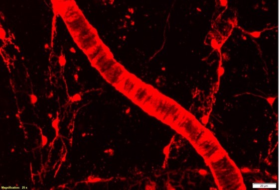 Two-photon image of mouse cortex in which a red fluorescent indicator is expressed in smooth muscle cells (large blood vessel) and in capillary pericytes (single cells on smaller vessels).