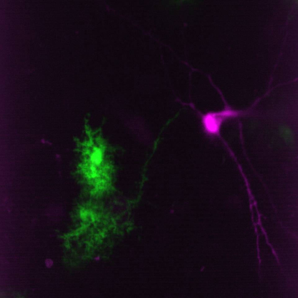 Simultaneous imaging of one neuron (purple) and two astrocytes (green) from the spinal cord.
