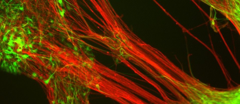 Human neurons generated from pluripotent stem cells