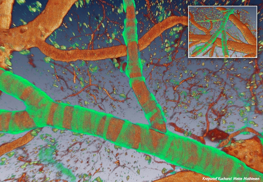 Blood vessels filled with red fluorescent marker (TRITC-dextran) and green calcium indicator in smooth muscle cells.